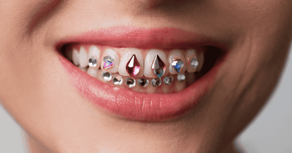 Are Tooth Gems Safe for Teeth?